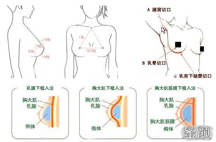 案例图片