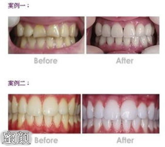https://img.yiyiaimei.com/mnt/Editor/2021-01-23/600bf039e87f5.jpg