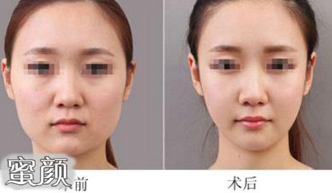 https://img.yiyiaimei.com/mnt/Editor/2021-01-24/600d2e7521d98.jpg