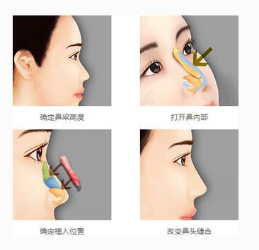 案例图片