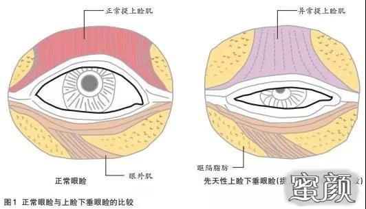 https://img.yiyiaimei.com/mnt/Editor/2021-01-26/60102012b544a.jpg