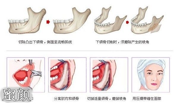 案例图片