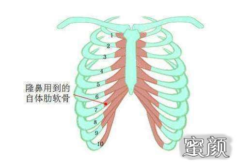 案例图片