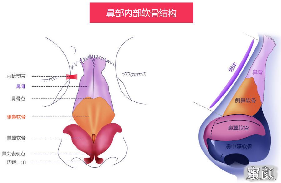 案例图片