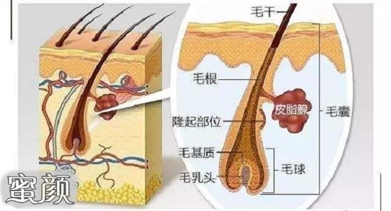 案例图片