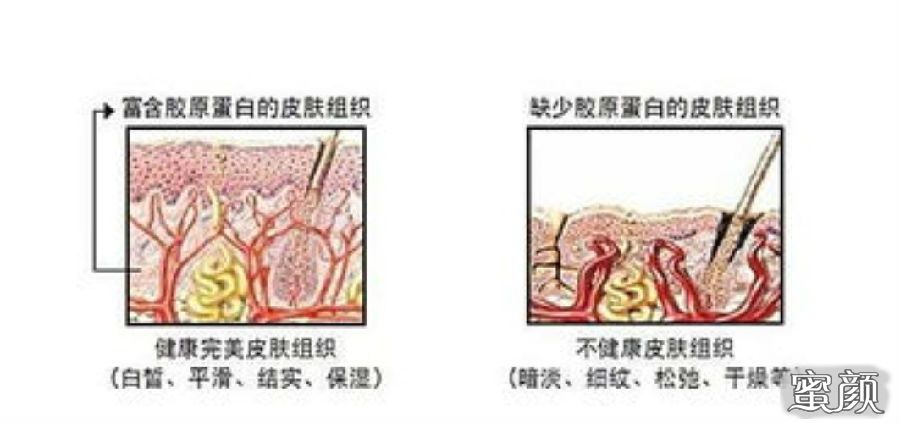 案例图片