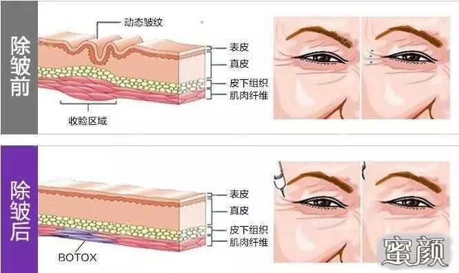 案例图片