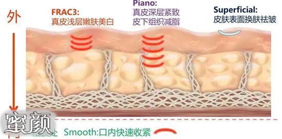 案例图片