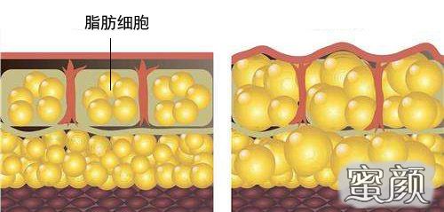 https://img.yiyiaimei.com/mnt/Editor/2021-02-02/6018e54214db5.jpg