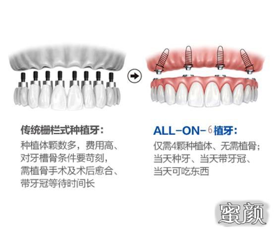 案例图片