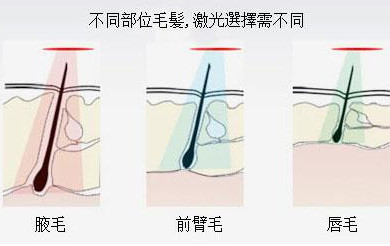 案例图片