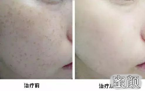 https://img.yiyiaimei.com/mnt/Editor/2021-02-03/601a8ffa92fcb.jpg