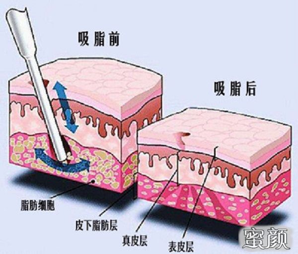 案例图片