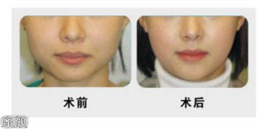 https://img.yiyiaimei.com/mnt/Editor/2021-02-06/601e94d1c4648.jpg