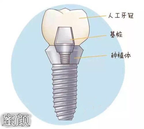 案例图片