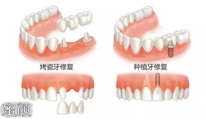 案例图片