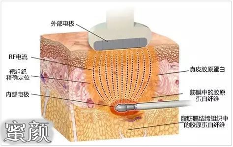 案例图片