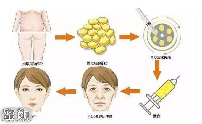 https://img.yiyiaimei.com/mnt/Editor/2021-02-13/6027a8c955933.jpg
