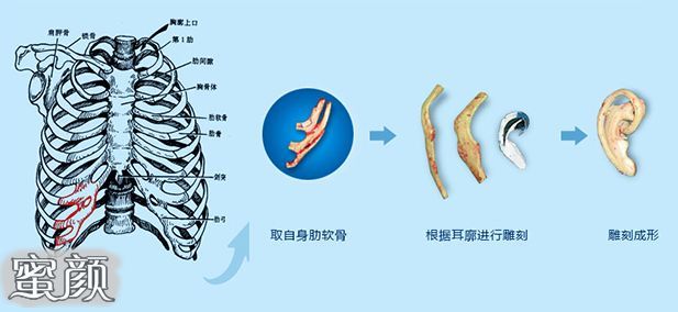 案例图片