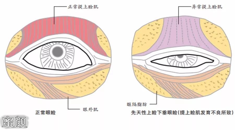 案例图片