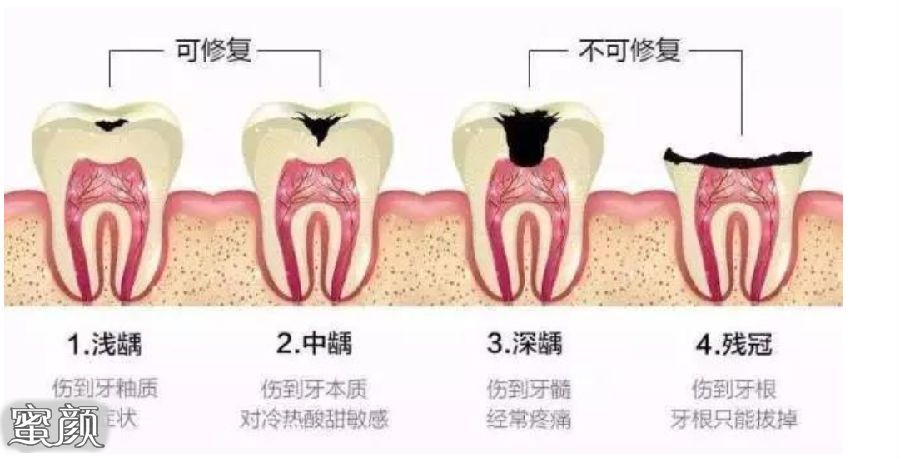 https://img.yiyiaimei.com/mnt/Editor/2021-02-22/6033a7d520836.jpg