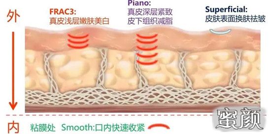 案例图片