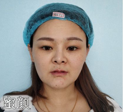 案例图片