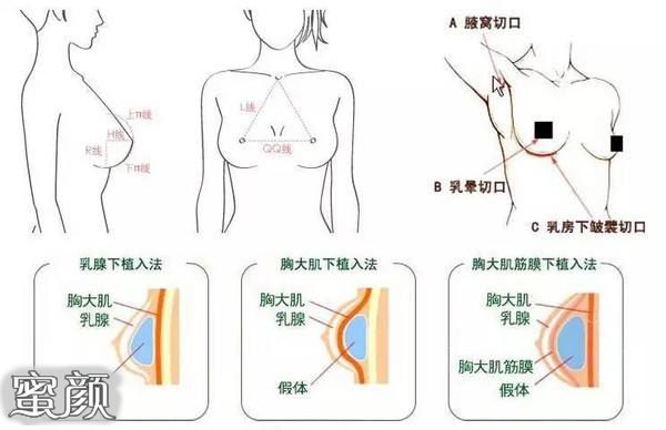 案例图片