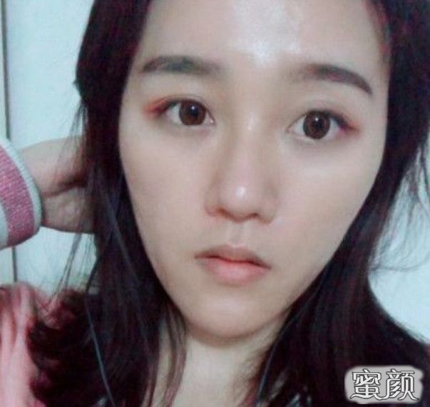 案例图片