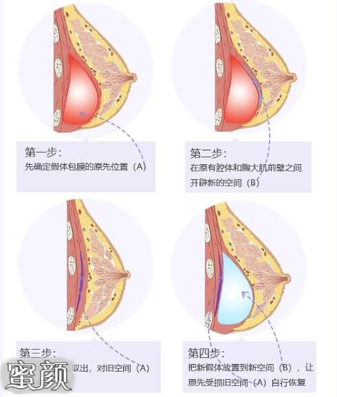 案例图片