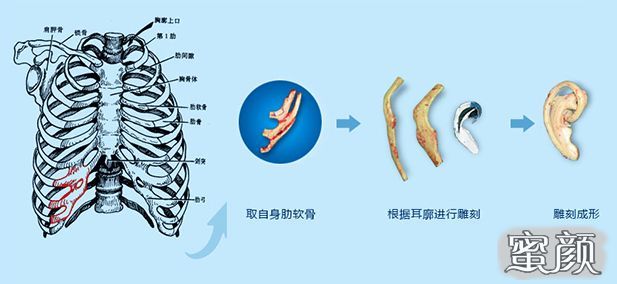 案例图片