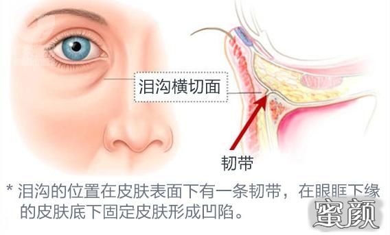 案例图片