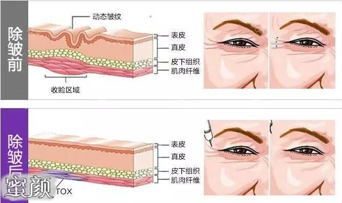 案例图片