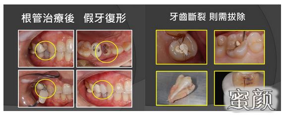 案例图片