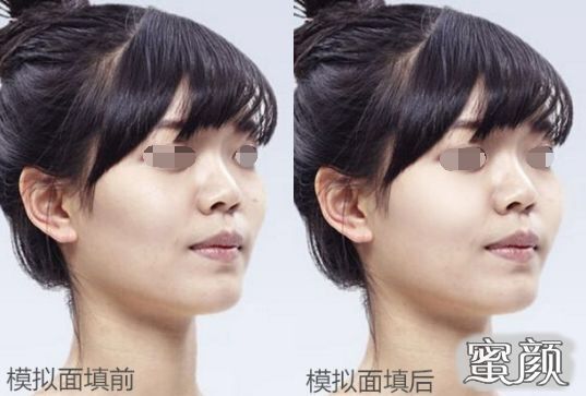 案例图片