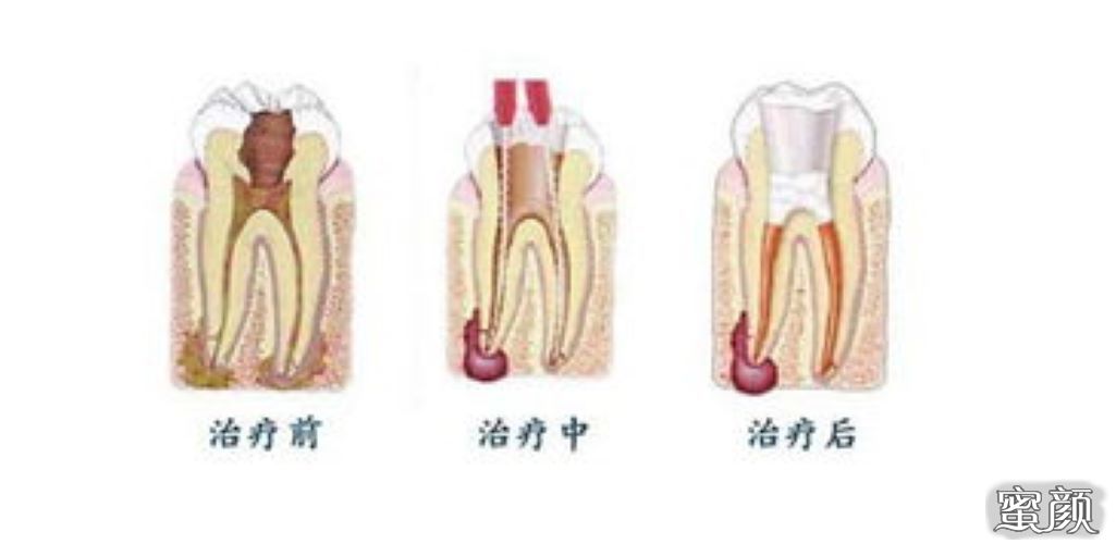 案例图片