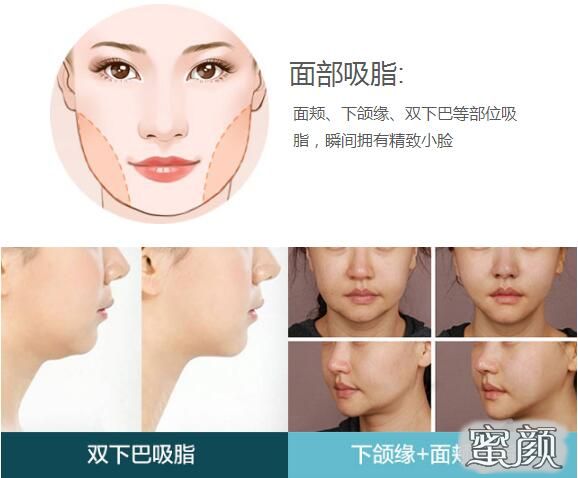 https://img.yiyiaimei.com/mnt/Editor/2021-05-09/6097f61ac3435.jpg