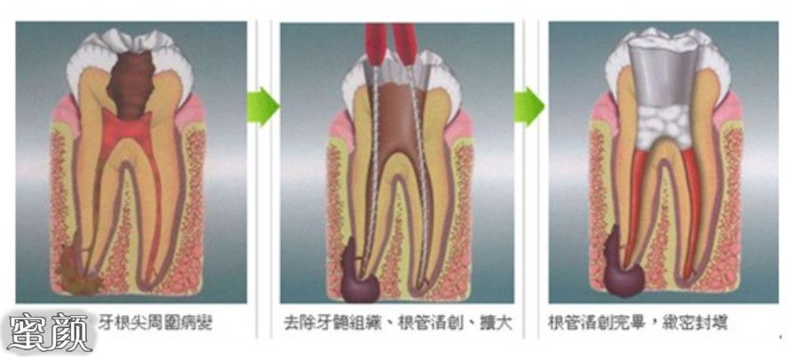 案例图片