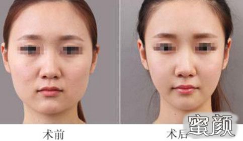 https://img.yiyiaimei.com/mnt/Editor/2021-05-19/60a52040d723a.jpg