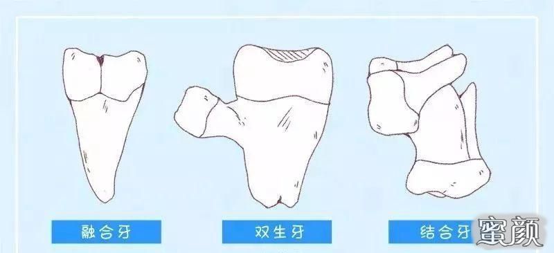 案例图片