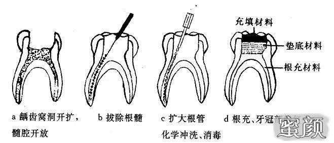 案例图片