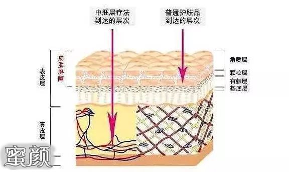案例图片