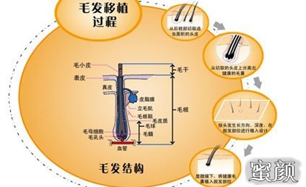 案例图片