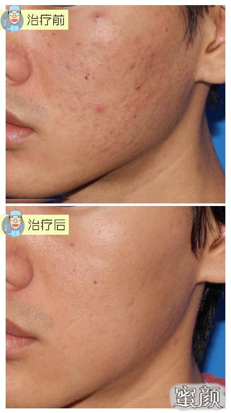 https://img.yiyiaimei.com/mnt/Editor/2021-06-06/60bce10cd4987.jpg