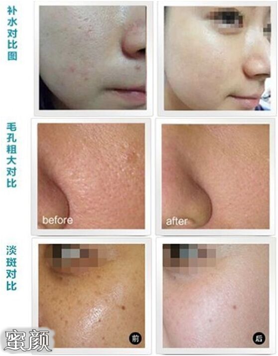 https://img.yiyiaimei.com/mnt/Editor/2021-06-06/60bce14f96cc9.jpg