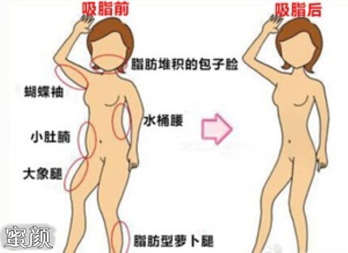https://img.yiyiaimei.com/mnt/Editor/2021-06-24/60d43de3742e6.jpg
