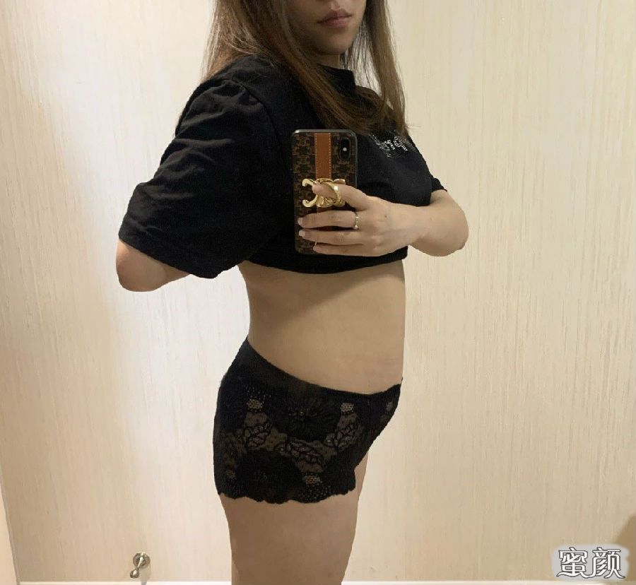 案例图片