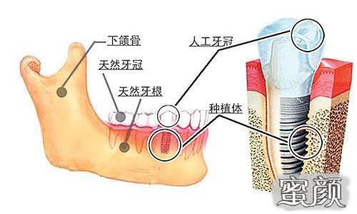 https://img.yiyiaimei.com/mnt/Editor/2021-06-29/60d9fc2ea2baf.jpg