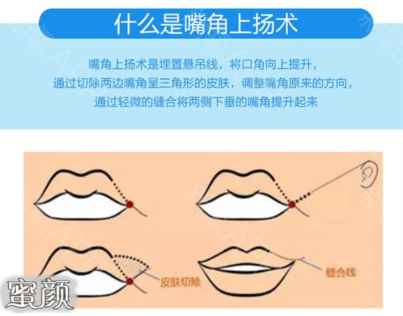 案例图片