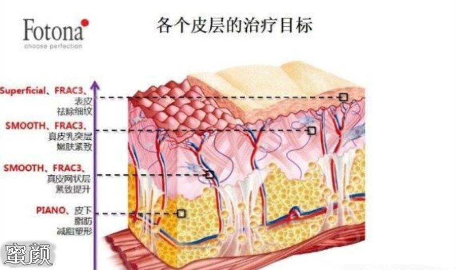 案例图片